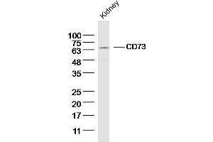 Image no. 1 for anti-5'-Nucleotidase, Ecto (CD73) (NT5E) (AA 151-250) antibody (ABIN1385637)