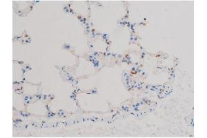 Image no. 6 for anti-V-Akt Murine Thymoma Viral Oncogene Homolog 1 (AKT1) (pThr450) antibody (ABIN6256564)
