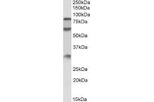 Image no. 2 for anti-Kininogen 1 (KNG1) (Internal Region) antibody (ABIN5539647)