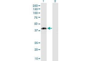 SPG11 antibody  (AA 1-425)