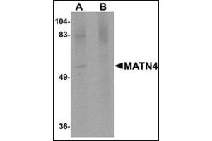 Image no. 2 for anti-Matrilin 4 (MATN4) (N-Term) antibody (ABIN500248)