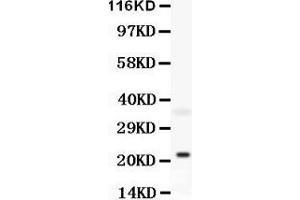 Image no. 1 for anti-BH3 Interacting Domain Death Agonist (BID) (AA 179-195), (C-Term) antibody (ABIN3042950)