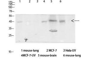 Image no. 2 for anti-Arrestin, beta 1 (ARRB1) (Ser157) antibody (ABIN3183382)