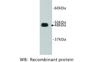 Image no. 1 for anti-FAT Tumor Suppressor Homolog 4 (FAT4) antibody (ABIN1112888)
