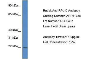 Image no. 1 for anti-Ribosomal Protein L12 (RPL12) (N-Term) antibody (ABIN2788886)