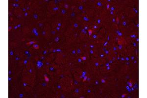 Image no. 2 for anti-Mitochondrial E3 Ubiquitin Protein Ligase 1 (MUL1) (AA 45-95) antibody (ABIN1385942)