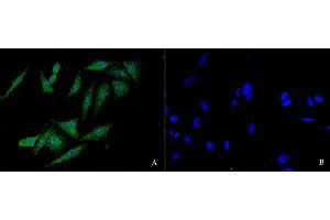 Image no. 3 for anti-Fanconi Anemia, Complementation Group C (FANCC) (N-Term) antibody (ABIN6924697)