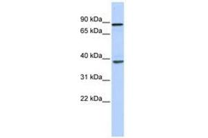 Image no. 1 for anti-DEAH (Asp-Glu-Ala-His) Box Polypeptide 35 (DHX35) (N-Term) antibody (ABIN6740494)