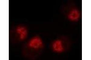 Image no. 2 for anti-Dystrobrevin Binding Protein 1 (DTNBP1) antibody (ABIN2966586)
