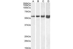 Image no. 6 for anti-Desmin (DES) (C-Term) antibody (ABIN334386)