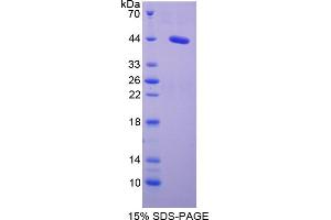 Image no. 1 for Serum Amyloid A2 (SAA2) (AA 20-122) protein (His tag,GST tag) (ABIN6236788)