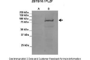 Image no. 2 for anti-Zinc Finger and BTB Domain Containing 16 (ZBTB16) (C-Term) antibody (ABIN2780737)