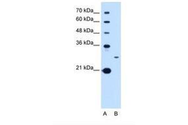 Tetraspanin 15 antibody  (C-Term)