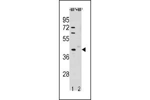 Image no. 1 for anti-serine/threonine Kinase 25 (STK25) (AA 347-375), (C-Term) antibody (ABIN1881851)