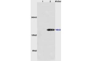 Lane 1: mouse stomach lysates Lane 2: mouse pancreas lysates probed with Anti GRM1 Polyclonal Antibody, Unconjugated (ABIN682708) at 1:200 in 4 °C.