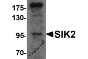 Image no. 1 for anti-Salt-Inducible Kinase 2 (SIK2) (Middle Region) antibody (ABIN1031093)