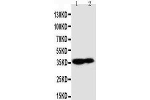 Image no. 1 for anti-Kallikrein 9 (KLK9) (AA 236-250), (C-Term) antibody (ABIN3043038)