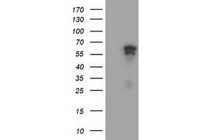 Image no. 3 for anti-Adrenocortical Dysplasia Homolog (ACD) antibody (ABIN2715649)
