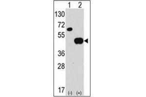 Image no. 3 for anti-Autophagy related 4B Cysteine Peptidase (ATG4B) (AA 23-53), (N-Term) antibody (ABIN1449637)