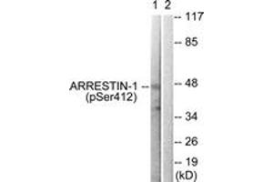 Western blot analysis of extracts from COS7 cells treated with Etoposide 25uM 60', using Arrestin 1 (Phospho-Ser412) Antibody.