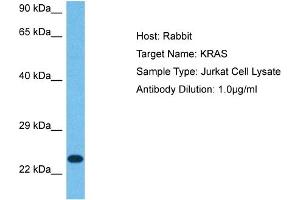 anti-GTPase Kras (KRAS) (N-Term) antibody