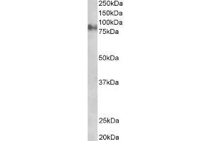 Image no. 4 for anti-Junction Plakoglobin (JUP) (C-Term) antibody (ABIN184775)