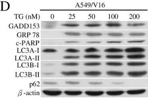 Image no. 13 for anti-Sequestosome 1 (SQSTM1) (Internal Region) antibody (ABIN2854836)