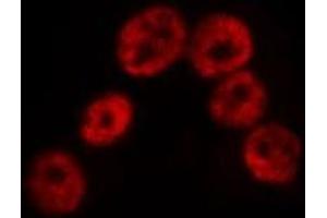 Image no. 3 for anti-SP100 Nuclear Antigen (SP100) (Internal Region) antibody (ABIN6257499)