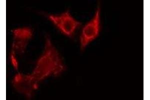 Image no. 1 for anti-Peroxisomal Biogenesis Factor 7 (PEX7) (C-Term) antibody (ABIN6257413)