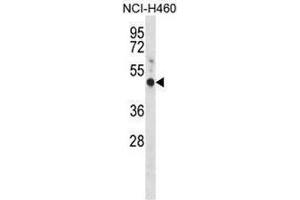 Image no. 1 for anti-G Protein-Coupled Estrogen Receptor 1 (GPER) (AA 345-375), (C-Term) antibody (ABIN952589)