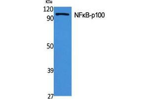 Image no. 2 for anti-Nuclear Factor of kappa Light Polypeptide Gene Enhancer in B-Cells 2 (NFKB2) (Thr160) antibody (ABIN3185875)
