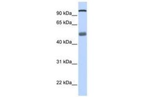 Image no. 1 for anti-DEAH (Asp-Glu-Ala-His) Box Polypeptide 32 (DHX32) (N-Term) antibody (ABIN6740491)