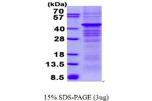 Image no. 1 for Protein Kinase, AMP-Activated, beta 1 Non-Catalytic Subunit (PRKAB1) protein (His tag) (ABIN6387066)