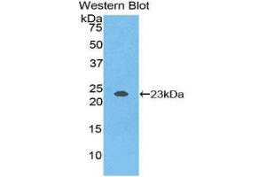 anti-NME/NM23 Nucleoside Diphosphate Kinase 3 (NME3) (AA 2-169) antibody