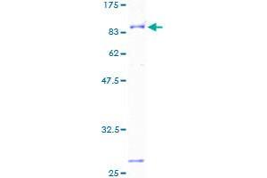 Image no. 1 for Biotinidase (BTD) (AA 1-543) protein (GST tag) (ABIN1346941)