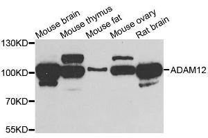 Image no. 2 for anti-ADAM Metallopeptidase Domain 12 (ADAM12) antibody (ABIN6136521)