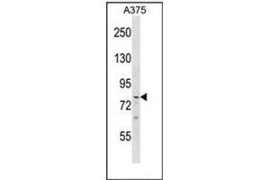 Image no. 1 for anti-PHD Finger Protein 21A (PHF21A) (AA 435-464), (Middle Region) antibody (ABIN954120)