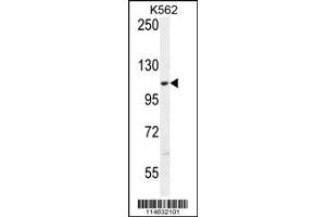 Western Blotting (WB) image for anti-Alanyl-tRNA Synthetase 2, Mitochondrial (AARS2) (Center) antibody (ABIN2158836)