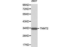 Image no. 1 for anti-Troponin T2, Cardiac (TNNT2) antibody (ABIN3021486)