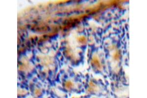 Image no. 2 for anti-Vascular Endothelial Growth Factor C (VEGFC) (AA 47-413) antibody (ABIN1078652)