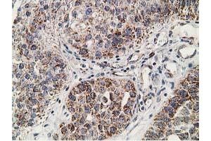 Image no. 6 for anti-Synovial Sarcoma, X Breakpoint 1 (SSX1) antibody (ABIN1501156)