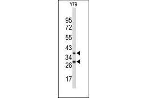 Image no. 1 for anti-F-Box Protein 4 (FBXO4) (AA 231-260), (Middle Region) antibody (ABIN952288)