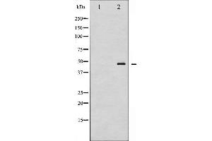 Image no. 7 for anti-GATA Binding Protein 1 (Globin Transcription Factor 1) (GATA1) (pSer142) antibody (ABIN6254982)