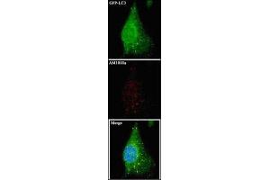 Image no. 1 for anti-Microtubule-Associated Protein 1 Light Chain 3 alpha (MAP1LC3A) antibody (ABIN5551132)