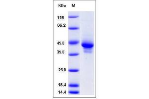 Image no. 1 for Chemokine (C-C Motif) Ligand 1 (CCL1) (AA 24-92) protein (Fc Tag) (ABIN2007463)