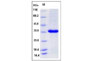 Proliferating Cell Nuclear Antigen (PCNA) (AA 1-261), (Mature) protein (His tag)