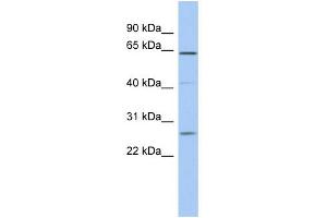 anti-Family with Sequence Similarity 71, Member B (FAM71B) (Middle Region) antibody