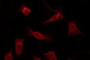 Image no. 1 for anti-TNFRSF1A-Associated Via Death Domain (TRADD) antibody (ABIN6265700)