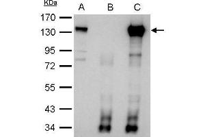 Image no. 3 for anti-CDKN1A Interacting Zinc Finger Protein 1 (CIZ1) (Internal Region) antibody (ABIN2855299)
