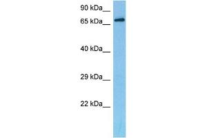 Image no. 2 for anti-Dachshund 2 (DACH2) (C-Term) antibody (ABIN2779633)